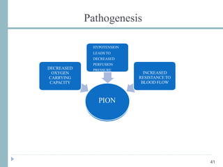 Pathogenesis
PION
DECREASED
OXYGEN
CARRYING
CAPACITY
HYPOTENSION
LEADS TO
DECREASED
PERFUSION
PRESSURE
INCREASED
RESISTANCETO
BLOOD FLOW
41
 