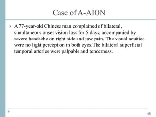 Case of A-AION
45
 A 77-year-old Chinese man complained of bilateral,
simultaneous onset vision loss for 5 days, accompanied by
severe headache on right side and jaw pain. The visual acuities
were no light perception in both eyes.The bilateral superficial
temporal arteries were palpable and tenderness.
 
