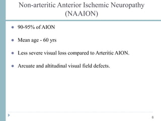 Non-arteritic Anterior Ischemic Neuropathy
(NAAION)
● 90-95% of AION
● Mean age - 60 yrs
● Less severe visual loss compared to Arteritic AION.
● Arcuate and altitudinal visual field defects.
6
 