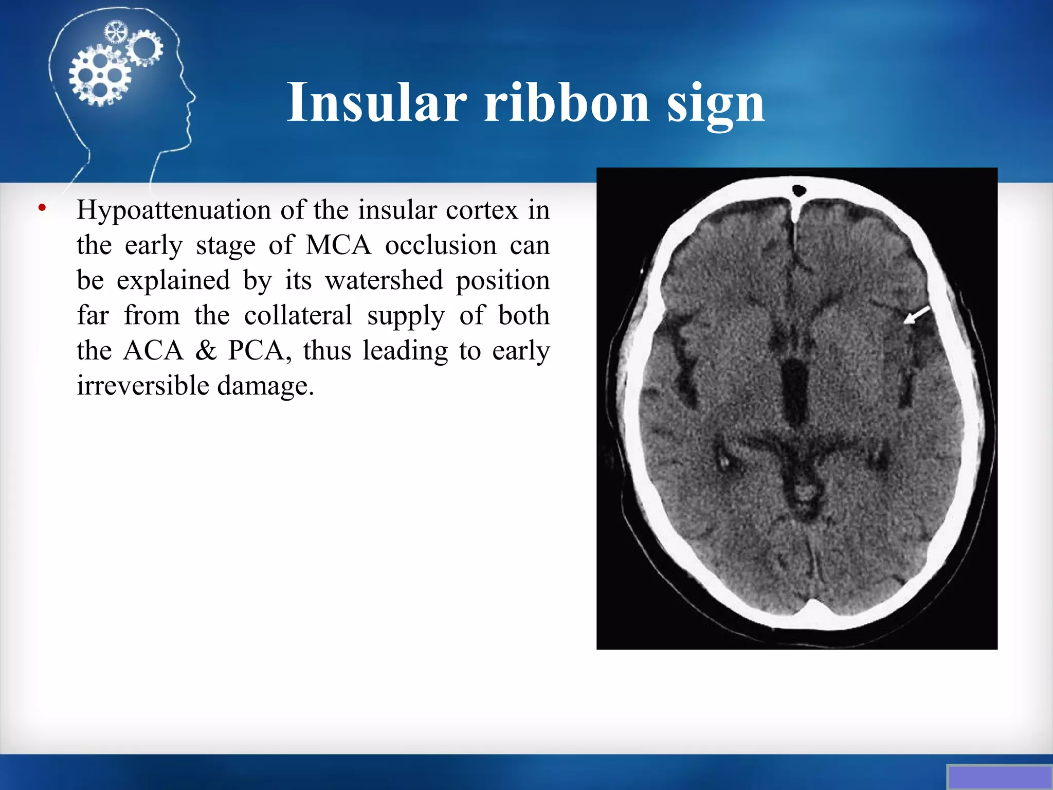 Insular ribbon sign
•   Hypoattenuation of the insular cortex in
    the early stage of MCA occlusion can
    be explained by its watershed position
    far from the collateral supply of both
    the ACA & PCA, thus leading to early
    irreversible damage.
 