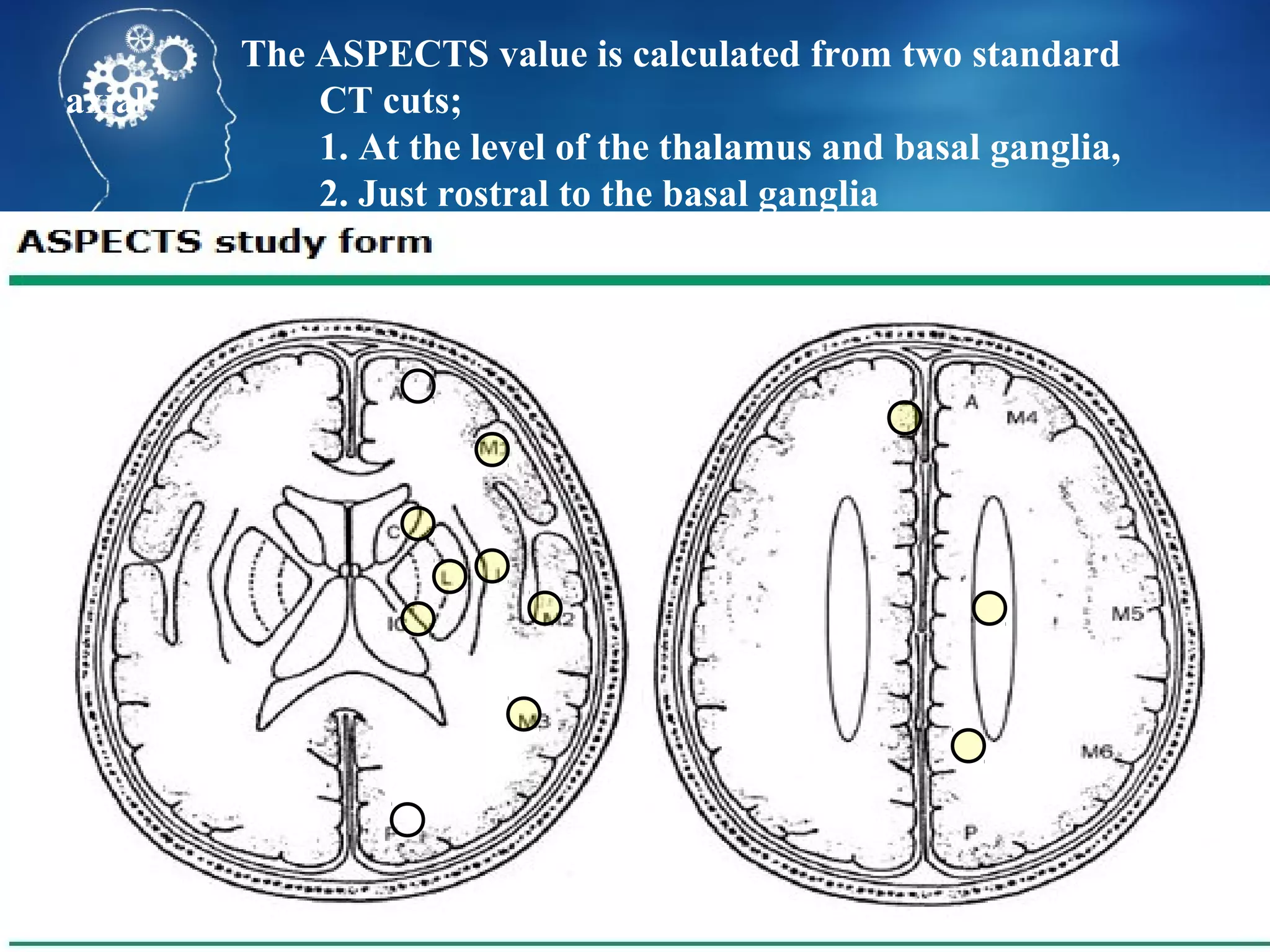 The ASPECTS value is calculated from two standard
axial       CT cuts;
            1. At the level of the thalamus and basal ganglia,
            2. Just rostral to the basal ganglia
 