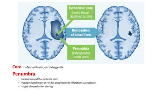 Core : Infarcted brain, not salvageable
Penumbra
• located around the ischemic core
• Hypoperfused brain at risk for progression to infarction, salvageable
• target of reperfusion therapy
 
