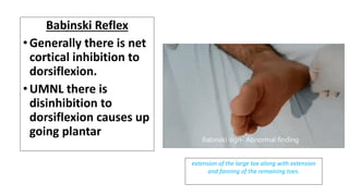 Babinski Reflex
•Generally there is net
cortical inhibition to
dorsiflexion.
•UMNL there is
disinhibition to
dorsiflexion causes up
going plantar
extension of the large toe along with extension
and fanning of the remaining toes.
 