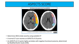 ASPECTS SCORE
• Determines MCA stroke severity using available CT
• A normal CT scan receives an ASPECTS of 10 points.
• An ASPECTS of ≤7 points highly correlates with negative functional outcome, determined
by Modified Rankin Scale (mRS).
 