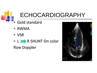 ECHOCARDIOGRAPHY
Gold standard
RWMA
VSR
L R SHUNT On color
flow Doppler
 
