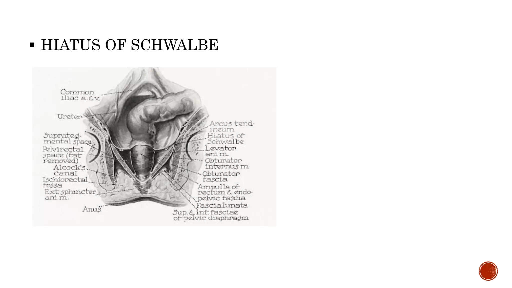  HIATUS OF SCHWALBE
 