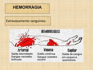 HEMORRAGIA
Extravasamento sanguíneo.
 