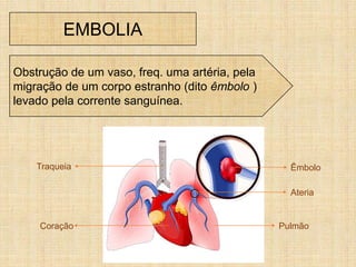EMBOLIA
Obstrução de um vaso, freq. uma artéria, pela
migração de um corpo estranho (dito êmbolo )
levado pela corrente sanguínea.
Êmbolo
Ateria
PulmãoCoração
Traqueia
 