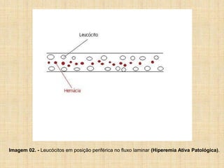 Imagem 02. - Leucócitos em posição periférica no fluxo laminar (Hiperemia Ativa Patológica).
 
