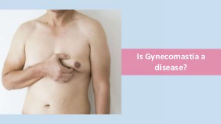 Is Gynecomastia a
disease?
 