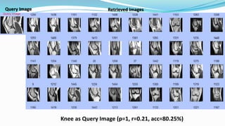 Knee as Query Image (p=1, r=0.21, acc=80.25%)
Query Image Retrieved Images
 