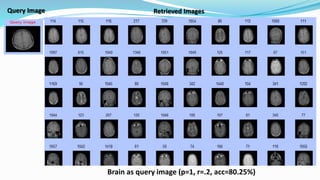 Brain as query image (p=1, r=.2, acc=80.25%)
Query Image Retrieved Images
 