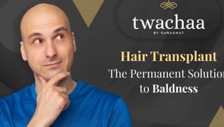 Is hair transplant permanent?