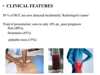 Pt Classification Rcc RENAL ANATOMY & RENAL CELL CANCERS | PPTX