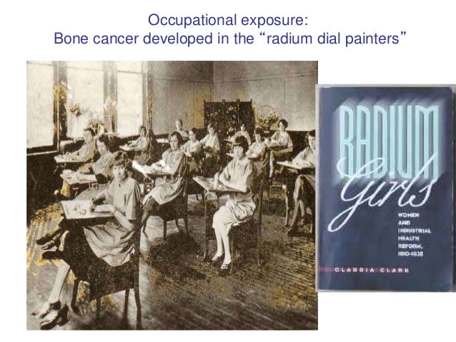 cancer from radium dial watch cancer from radium dial watch