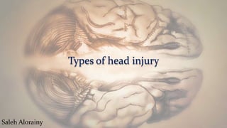 Types of head injury
Saleh Alorainy
 