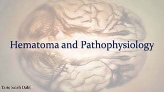 Hematoma and Pathophysiology
Tariq Saleh Dabil
 