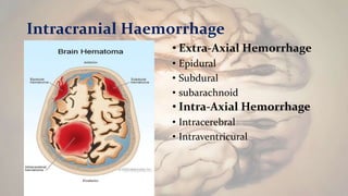 Intracranial Haemorrhage
• Extra-Axial Hemorrhage
• Epidural
• Subdural
• subarachnoid
• Intra-Axial Hemorrhage
• Intracerebral
• Intraventricural
 