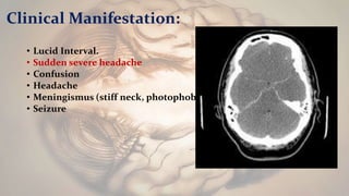 Clinical Manifestation:
• Lucid Interval.
• Sudden severe headache
• Confusion
• Headache
• Meningismus (stiff neck, photophobia)
• Seizure
 