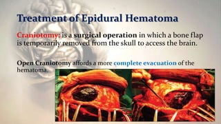 Treatment of Epidural Hematoma
Craniotomy: is a surgical operation in which a bone flap
is temporarily removed from the skull to access the brain.
Open Craniotomy affords a more complete evacuation of the
hematoma.
 
