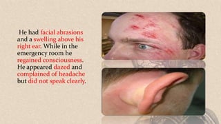 He had facial abrasions
and a swelling above his
right ear. While in the
emergency room he
regained consciousness.
He appeared dazed and
complained of headache
but did not speak clearly.
 