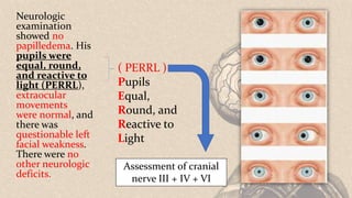 Neurologic
examination
showed no
papilledema. His
pupils were
equal, round,
and reactive to
light (PERRL),
extraocular
movements
were normal, and
there was
questionable left
facial weakness.
There were no
other neurologic
deficits.
( PERRL )
Pupils
Equal,
Round, and
Reactive to
Light
Assessment of cranial
nerve III + IV + VI
 