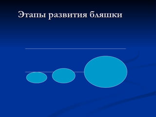 Этапы развития бляшки 