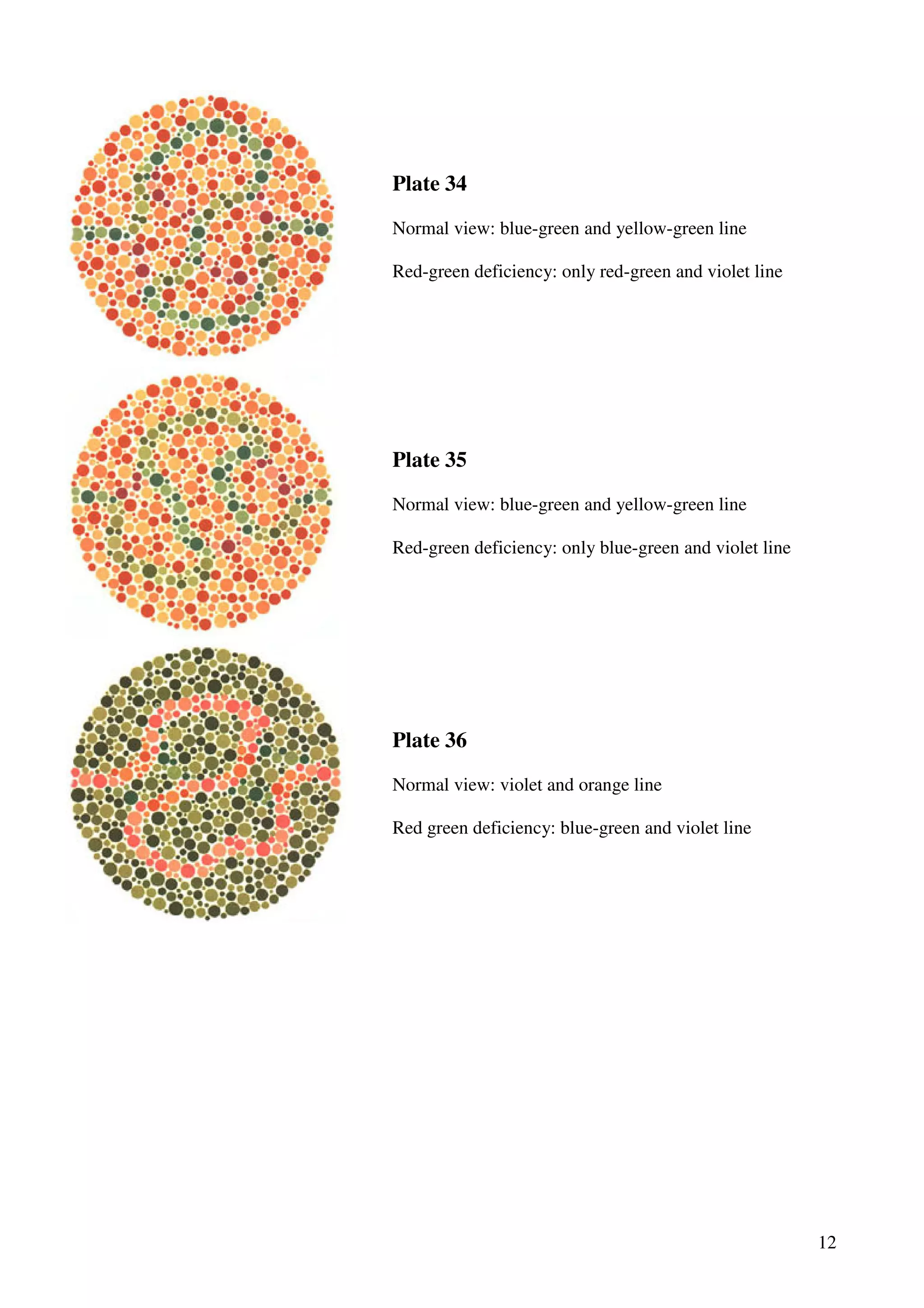 12
Plate 34
Normal view: blue-green and yellow-green line
Red-green deficiency: only red-green and violet line
Plate 35
Normal view: blue-green and yellow-green line
Red-green deficiency: only blue-green and violet line
Plate 36
Normal view: violet and orange line
Red green deficiency: blue-green and violet line
 