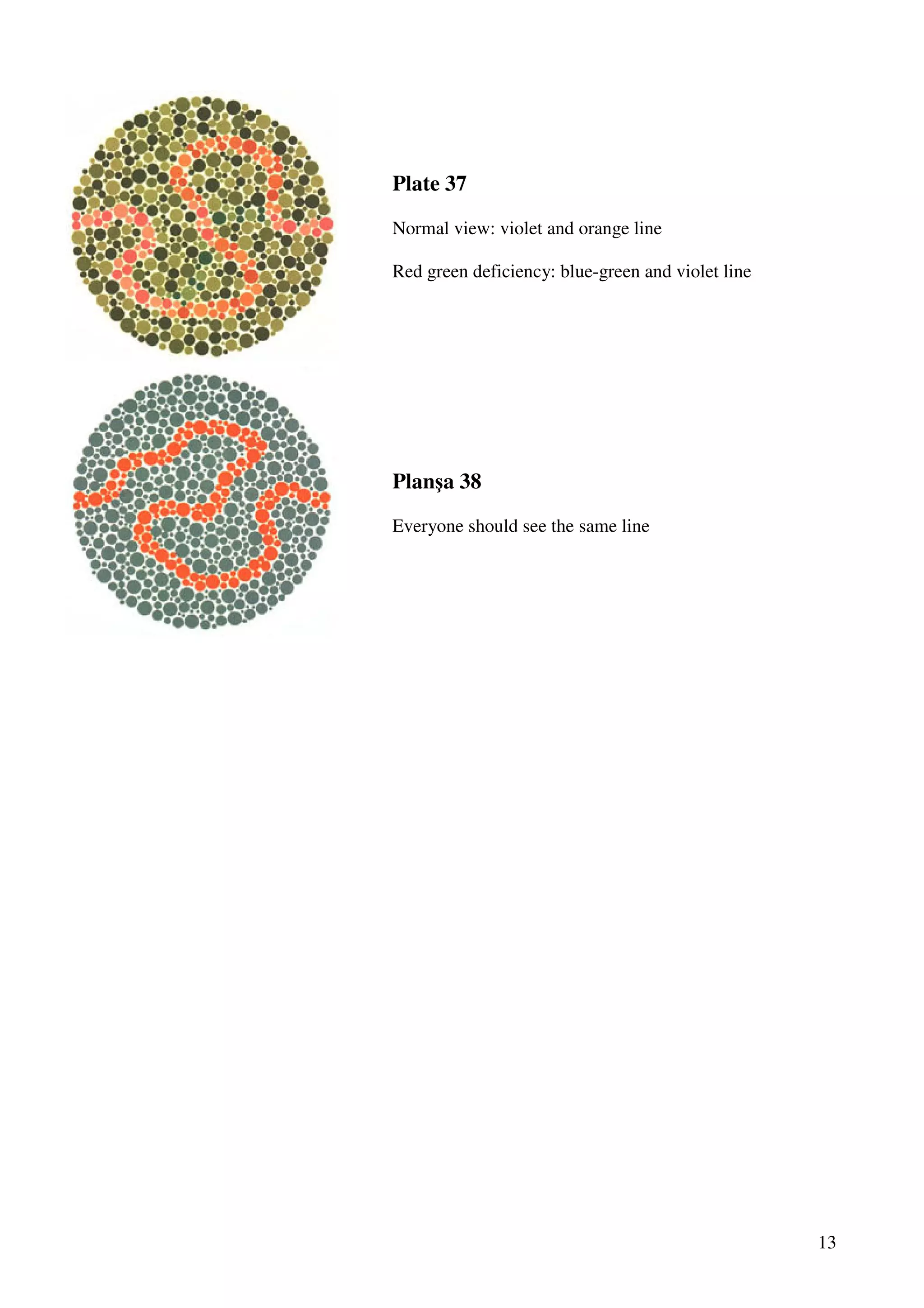 13
Plate 37
Normal view: violet and orange line
Red green deficiency: blue-green and violet line
Planşa 38
Everyone should see the same line
 