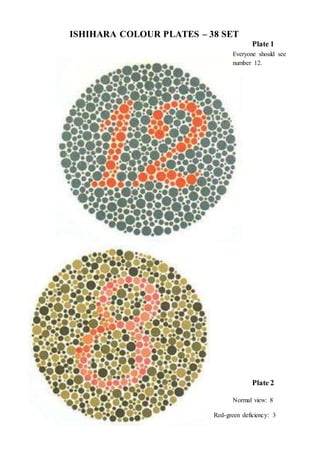 ISHIHARA COLOUR PLATES – 38 SET
Plate 1
Everyone should see
number 12.
Plate 2
Normal view: 8
Red-green deficiency: 3
 