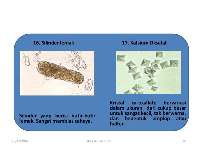 atlas sedimen urine