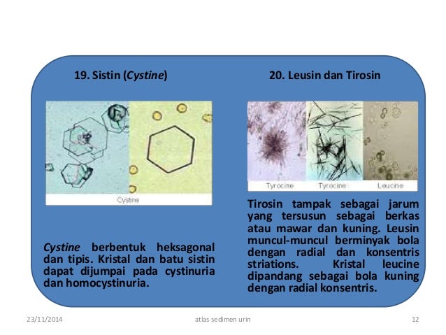 atlas sedimen urine