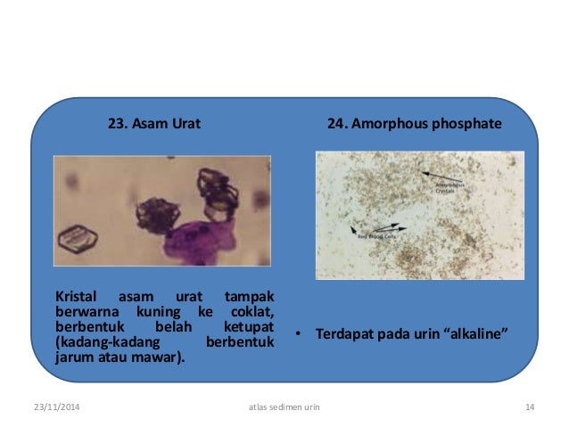 atlas sedimen urine