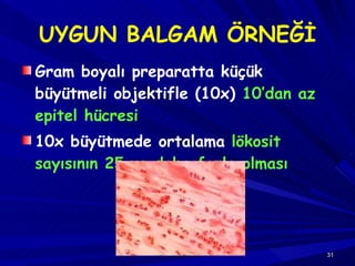 UYGUN BALGAM ÖRNEĞİ Gram boyalı preparatta küçük büyütmeli objektifle (10x)  10’dan az epitel hücresi 10x büyütmede ortalama  lökosit sayısının 25 ve daha fazla olması 