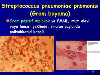 Streptococcus pneumoniae pnömonisi (Gram boyama) Gram pozitif diplokok  ve PMNL, mum alevi veya lanset şeklinde, virulan suşlarda polisakkarid kapsül 