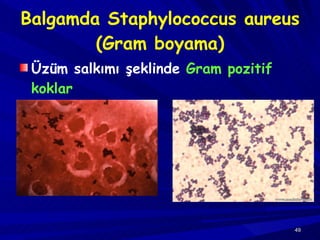 Balgamda Staphylococcus aureus (Gram boyama) Üzüm salkımı şeklinde  Gram pozitif koklar 