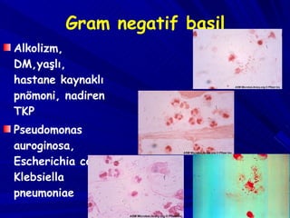 Gram negatif basil Alkolizm, DM,yaşlı, hastane kaynaklı pnömoni, nadiren TKP Pseudomonas auroginosa, Escherichia coli, Klebsiella pneumoniae 