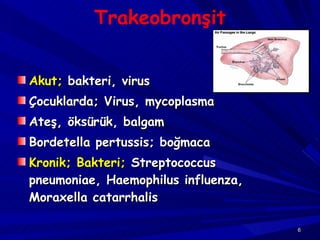 Trakeobronşit Akut;  bakteri, virus Çocuklarda; Virus, mycoplasma Ateş, öksürük, balgam Bordetella pertussis; boğmaca Kronik; Bakteri;  Streptococcus pneumoniae, Haemophilus influenza, Moraxella catarrhalis  