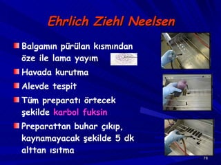 Ehrlich Ziehl Neelsen Balgamın pürülan kısmından öze ile lama yayım Havada kurutma Alevde tespit Tüm preparatı örtecek şekilde  karbol fuksin Preparattan buhar çıkıp, kaynamayacak şekilde 5 dk alttan ısıtma 