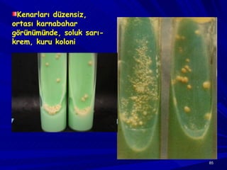 Kenarları düzensiz, ortası karnabahar görünümünde, soluk sarı-krem, kuru koloni 