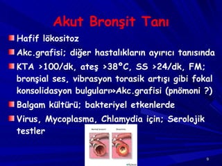 Akut Bronşit Tanı Hafif lökositoz Akc.grafisi; diğer hastalıkların ayırıcı tanısında KTA  > 100/dk, ateş  > 38 º C, SS  > 24/dk, FM; bronşial ses, vibrasyon torasik artışı gibi fokal konsolidasyon bulguları » Akc.grafisi (pnömoni ?)  Balgam kültürü; bakteriyel etkenlerde Virus, Mycoplasma, Chlamydia için; Serolojik testler 