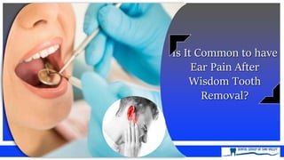 Is It Common to have
Ear Pain After
Wisdom Tooth
Removal?
 