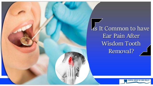 Is It Common To Have Ear Pain After Wisdom Tooth Removal