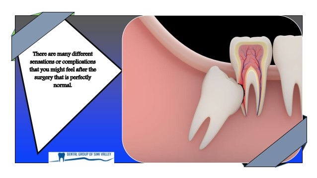 Is it Common to have Ear Pain After Wisdom Tooth Removal Is it Common to have Ear Pain After Wisdom Tooth Removal