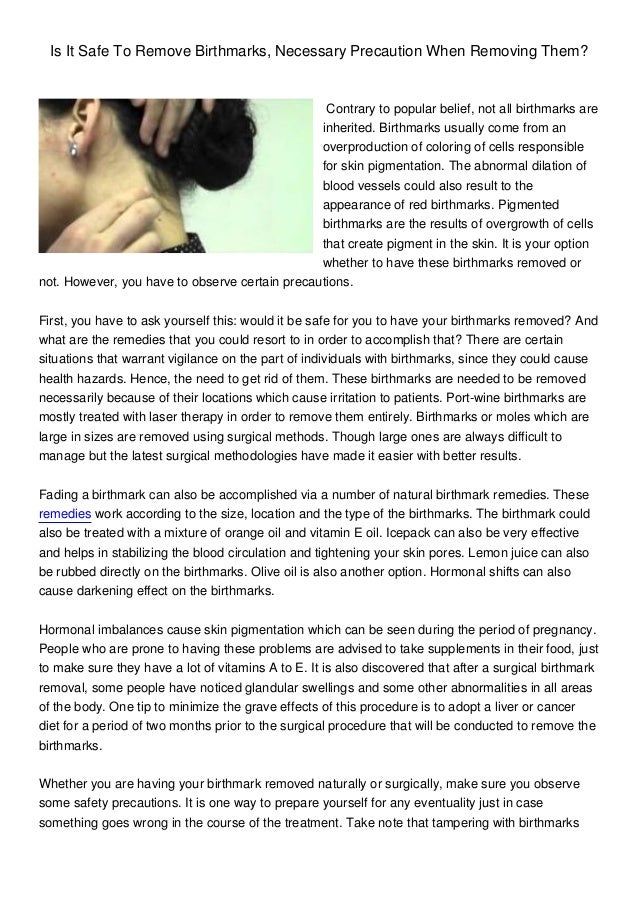 Birthmark Blues Try These Simple Techniques For How To Get Rid Of Birthmarks Naturally 3 - hw8h3vj