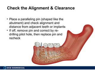 Isi tsi treatment planning and placement (updated design) | PPS