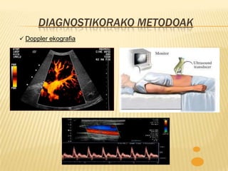 DIAGNOSTIKORAKO METODOAK
 Doppler ekografia
 