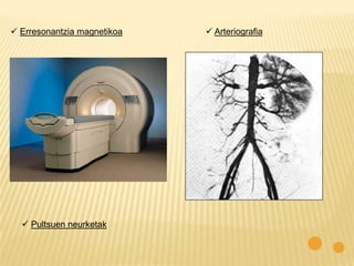  Erresonantzia magnetikoa    Arteriografia




   Pultsuen neurketak
 