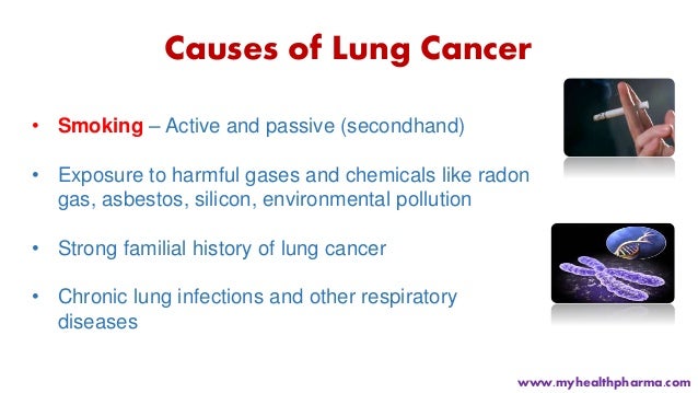 Is Lung Cancer Killing Women More Than Breast Cancer