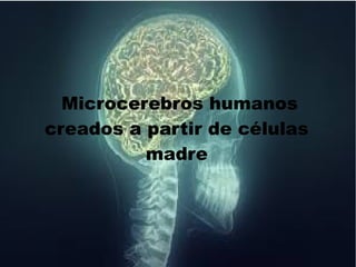 Microcerebros humanos
creados a partir de células
madre
 
